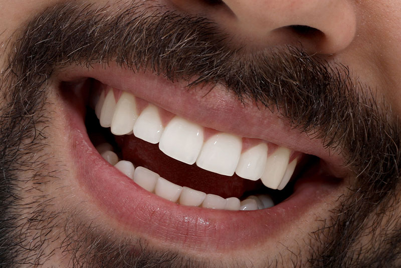 close up of before and after dental procedure